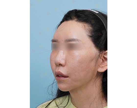 Woman with headband, facing left, blue background.