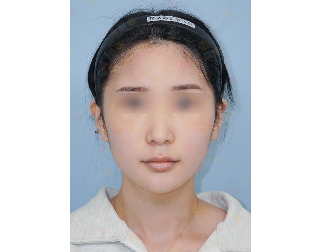 Close-up of person's face with headband.