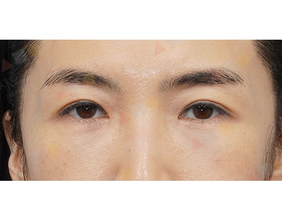 Close-up of a person's eyes and eyebrows.