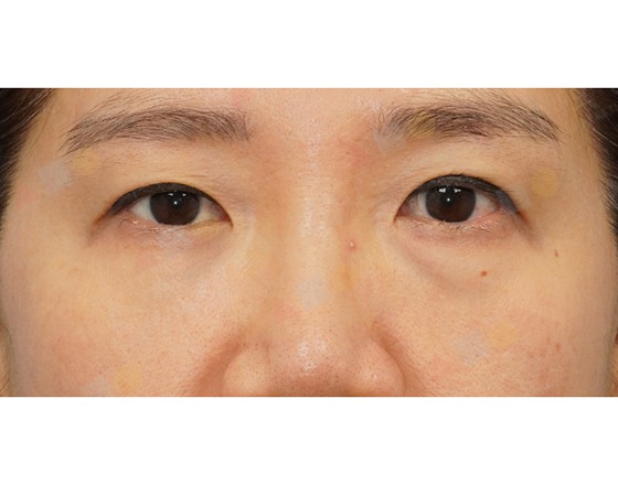 Close-up of a person's eyes and eyebrows.