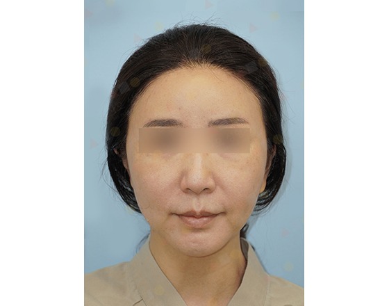 Person with obscured eyes against blue background.