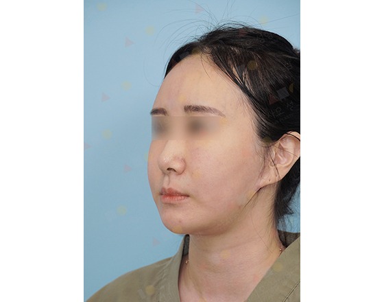 Woman with blurred eyes, blue background