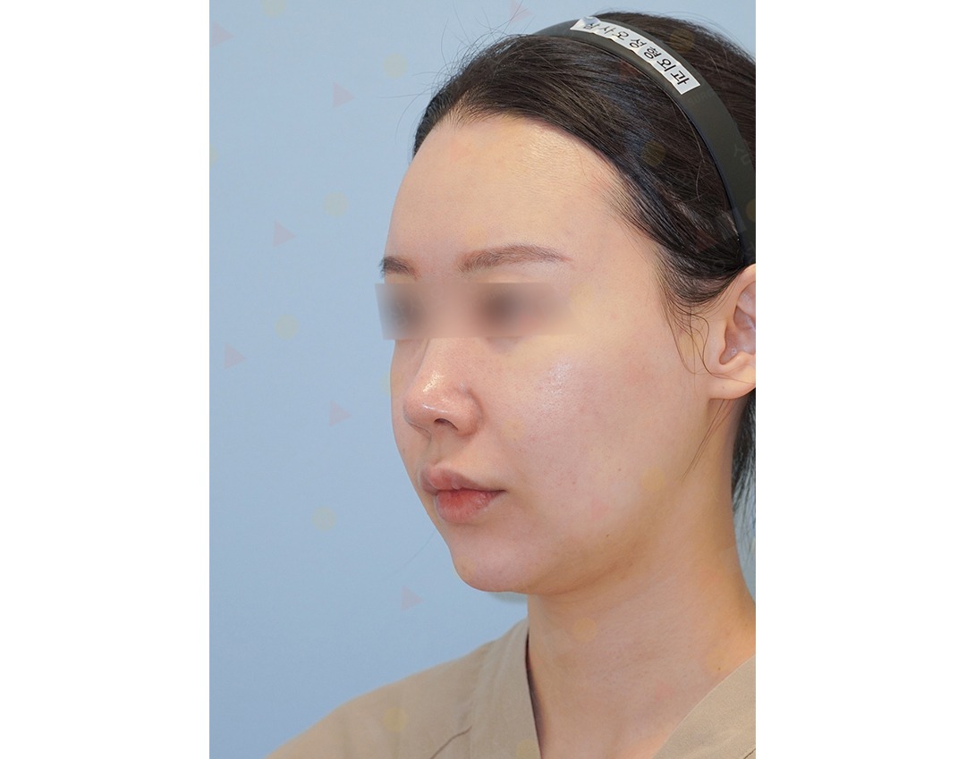 Woman with headband in side profile view.