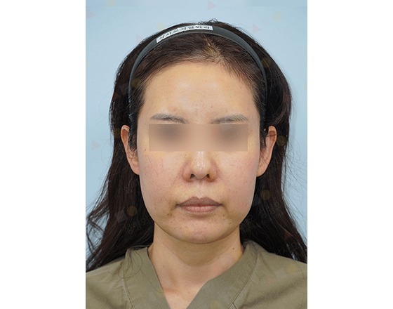 Woman with blurred eyes, headband visible