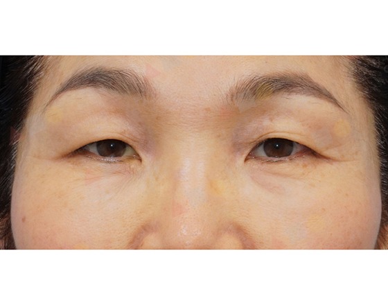 Close-up of woman's eyes and eyebrows.