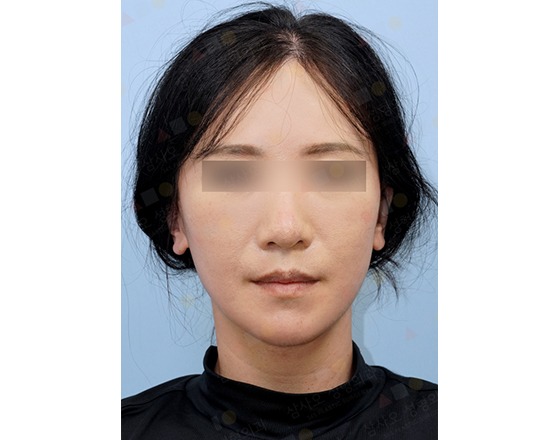 Person with neutral expression against blue background.