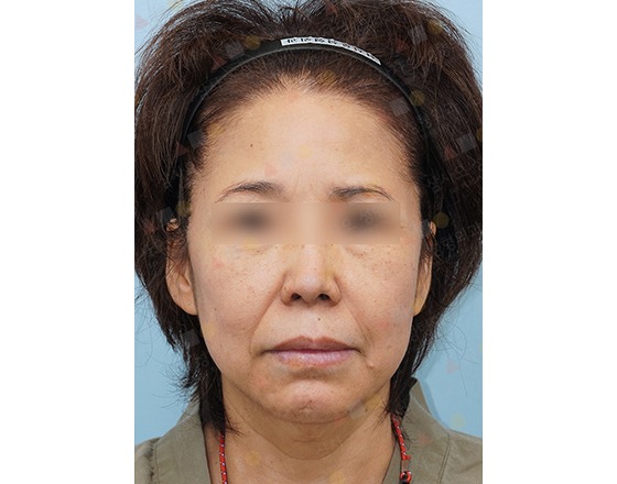 Woman with headband, neutral expression