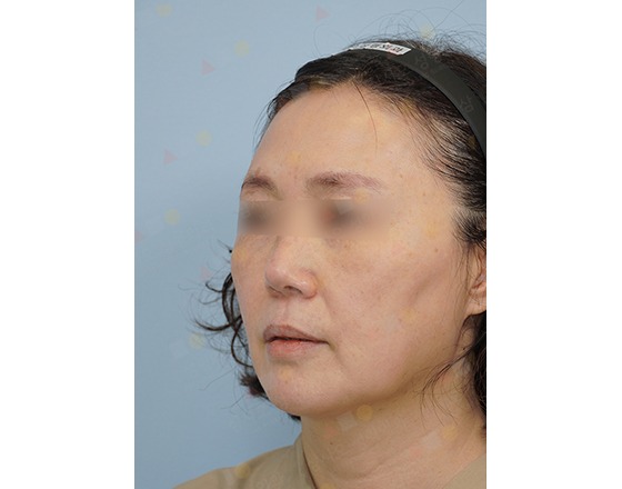 Person with blurred eyes, wearing headband, light background.