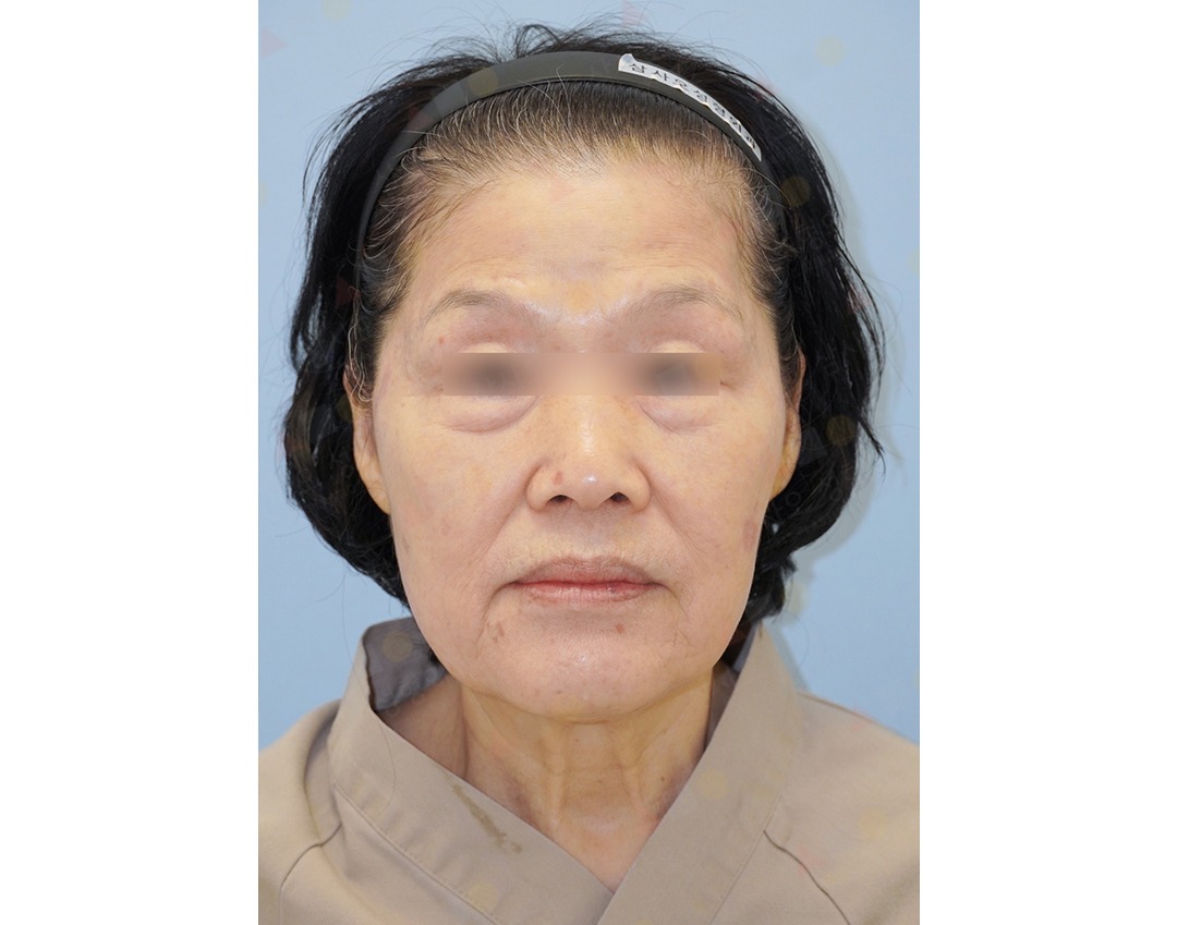 Elderly woman with blurred eyes, wearing headband