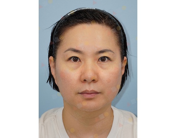 Person with headband looking forward against blue background.