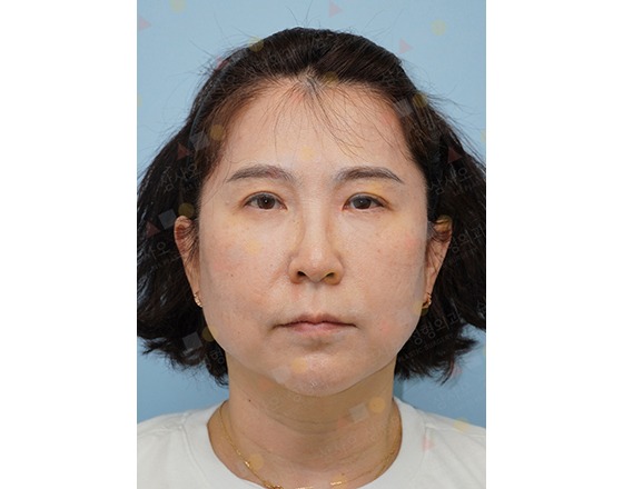 Woman with short hair facing forward