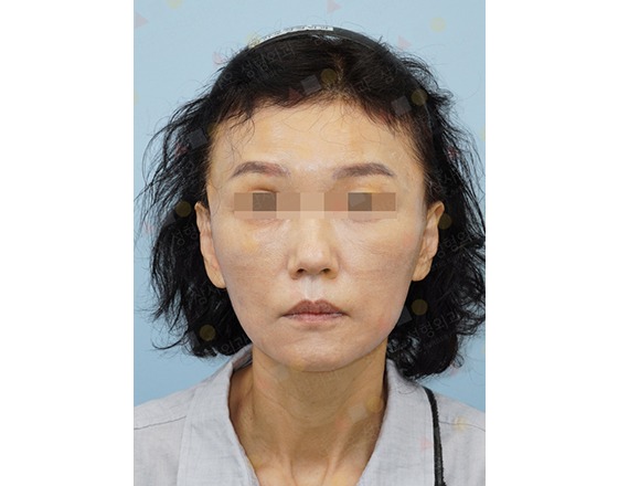 Person with short dark hair, neutral expression.