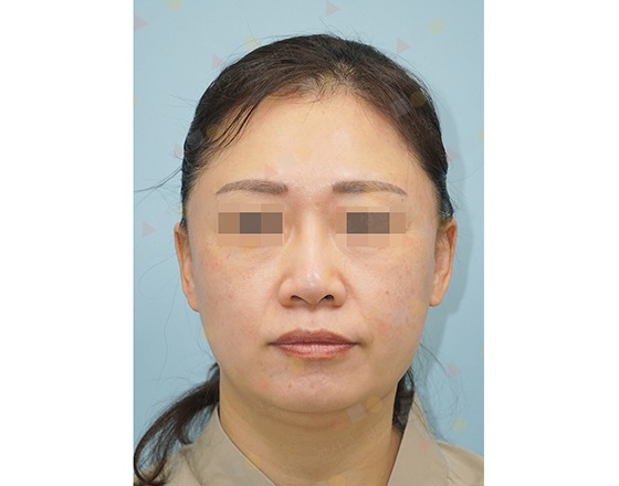 Portrait of a woman with pixelated eyes.