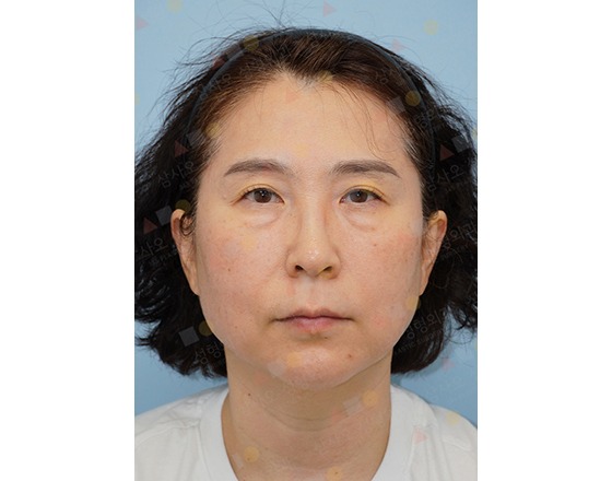 Person with short hair and blank expression.