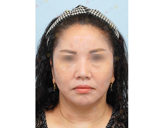 Woman with headband facing forward, neutral expression.