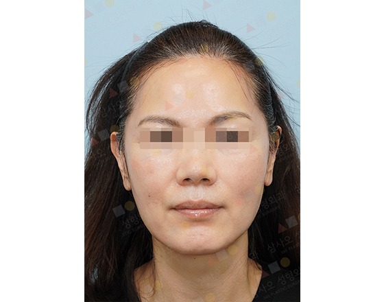 Woman with pixelated eyes, neutral expression.