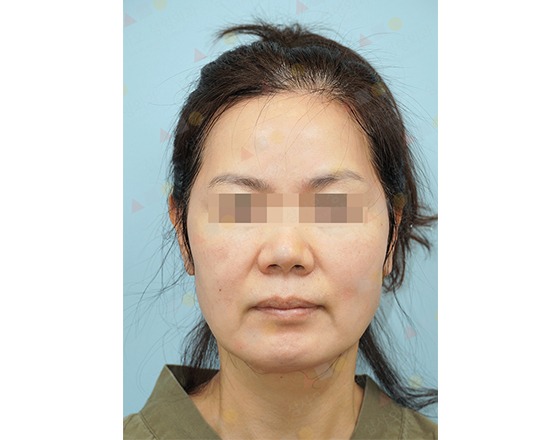 Neutral expression, headshot of a person.