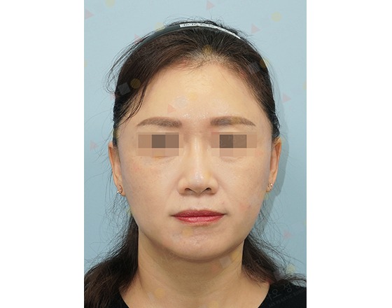 Woman with obscured eyes facing camera