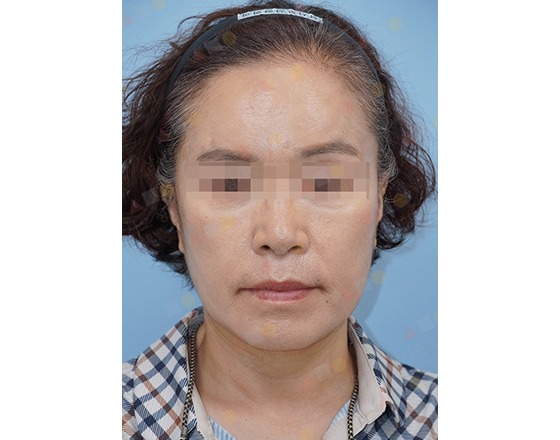 Woman with pixelated eyes poses against blue background.