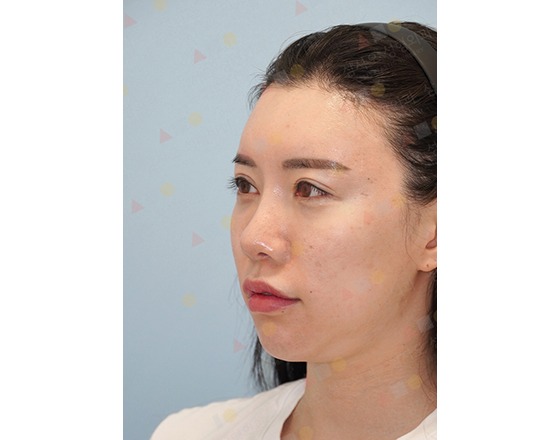 Woman with clear skin, side profile view