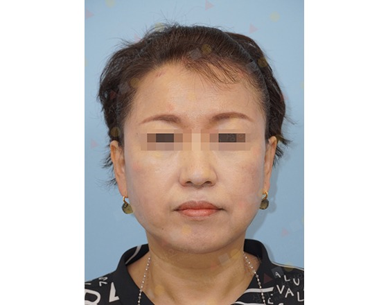 Woman with medium hair, blue background.