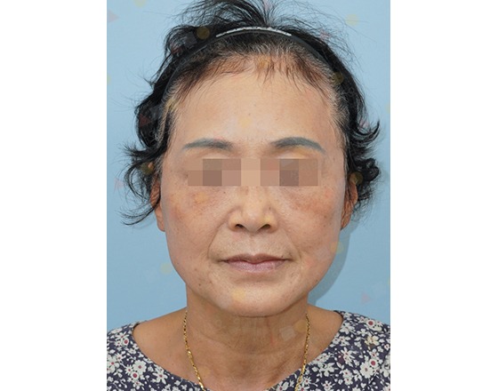 Woman with pixelated eyes, blue background.