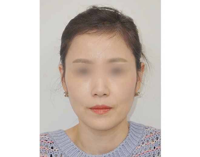 Woman with blurred eyes, wearing earrings and sweater.