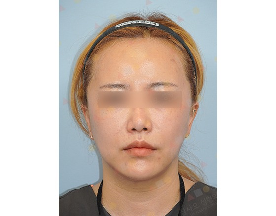 Person with headband posing for portrait.