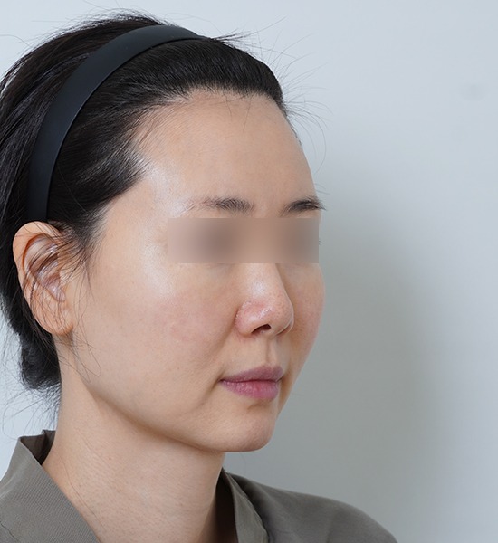 Woman with headband looking left