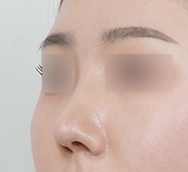 Close-up of a person's nose and eyebrow.