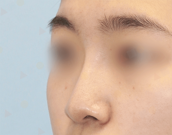 Close-up of smooth skin with blurred eyes.