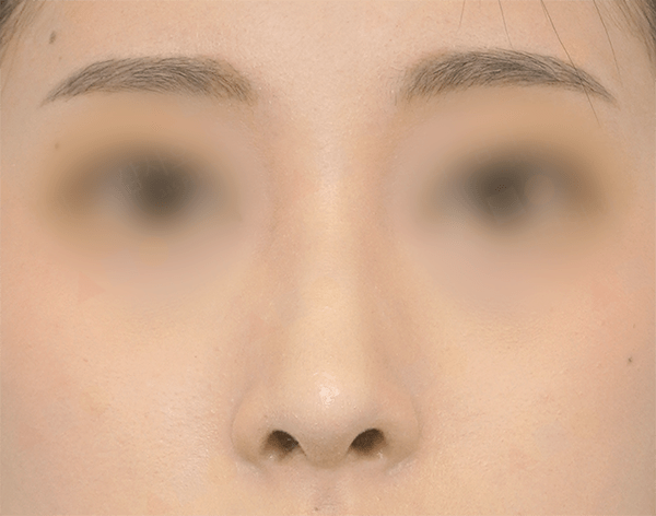 Close-up of a person's face with blurred eyes.