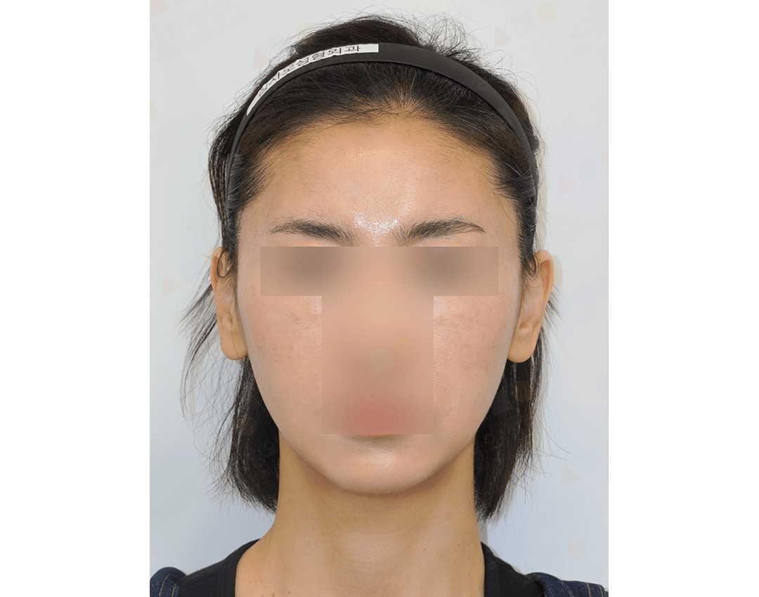 Person with face blurred for privacy.