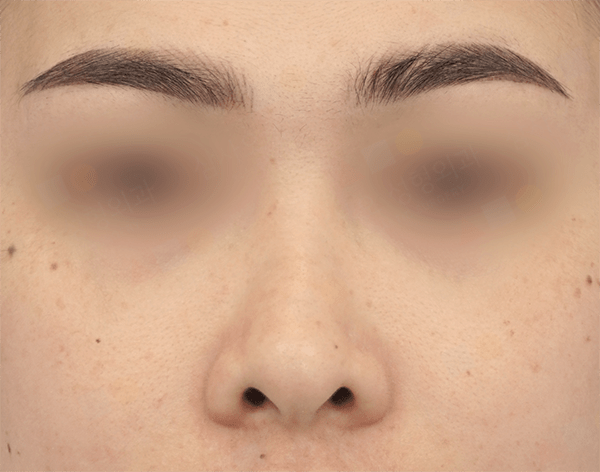 Close-up of woman's eyebrows and nose