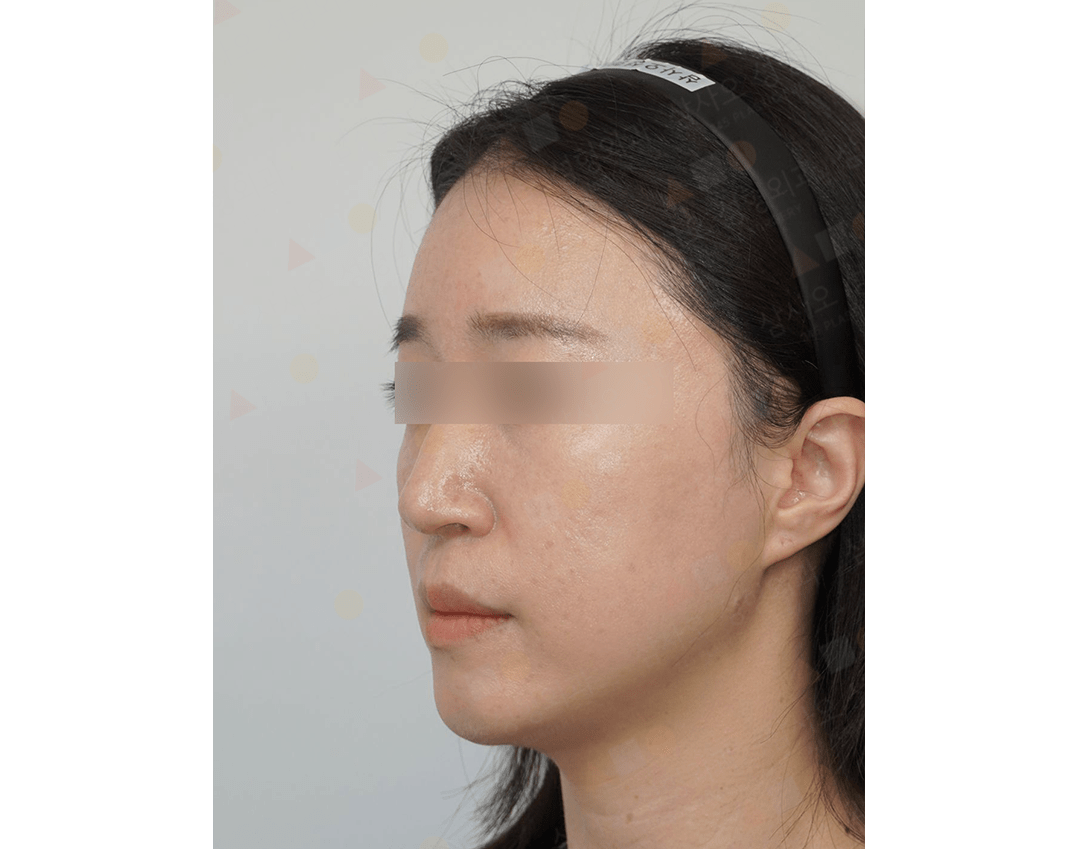 Woman with headband in profile view.