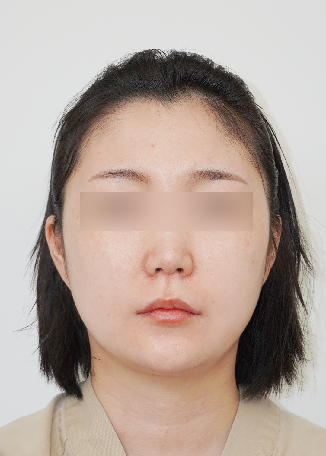 Person with blurred eyes, neutral expression