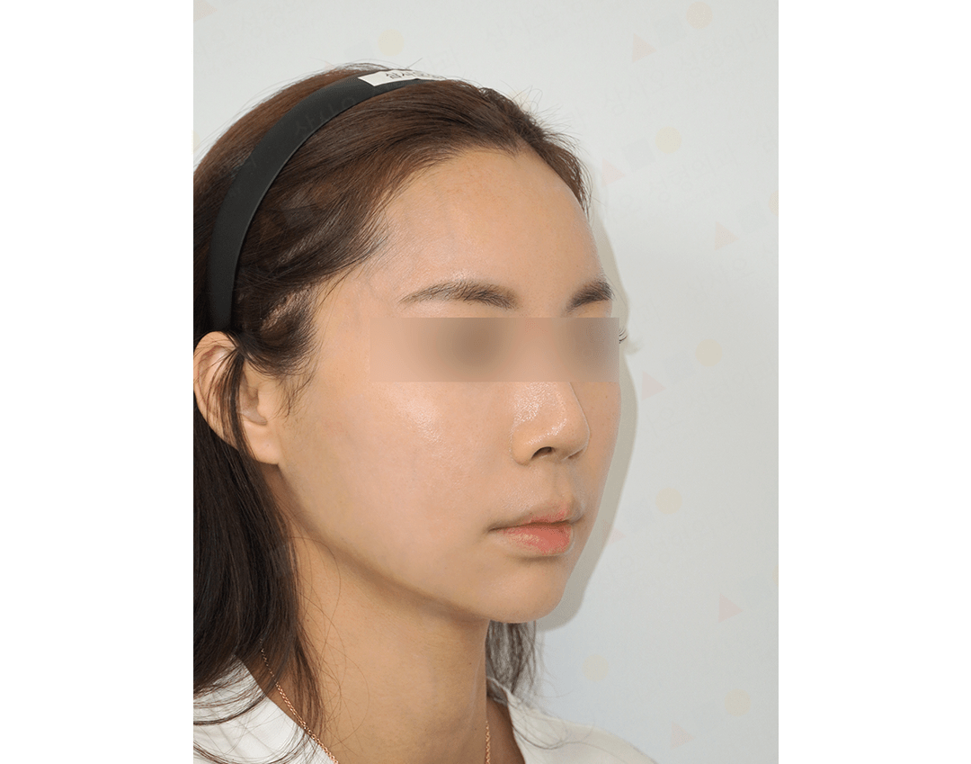 Profile view of person with blurred eyes.