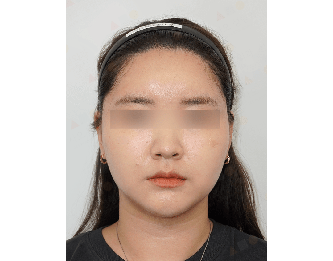 Person with headband and closed mouth