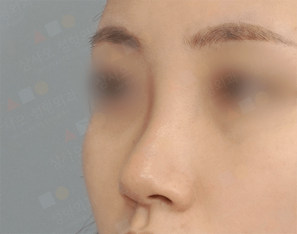 Close-up of person's nose and eyebrow profile.