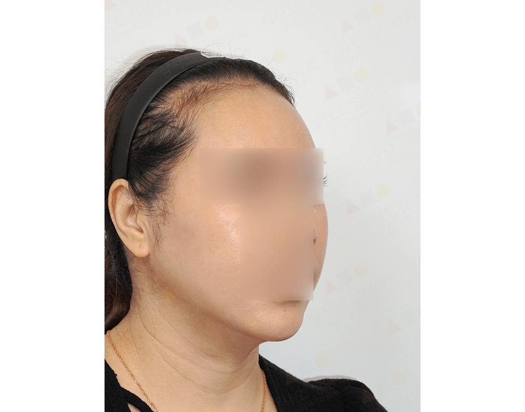 Woman with blurred face wearing headband