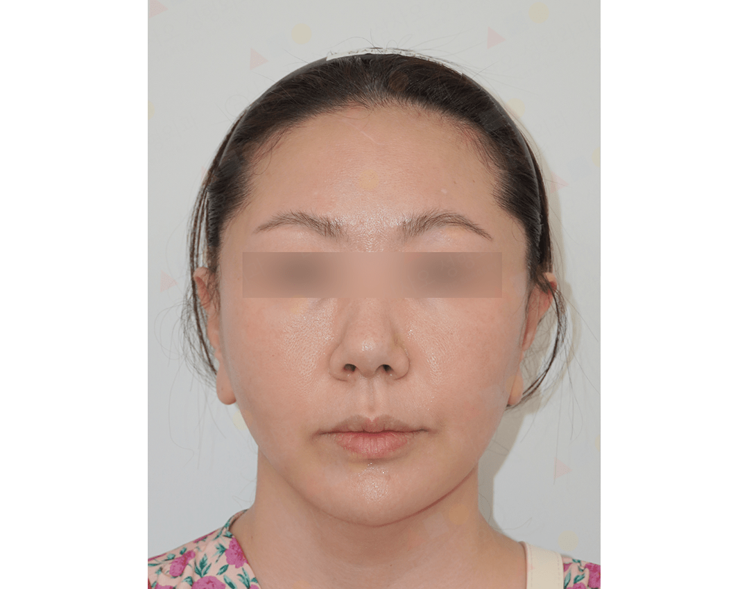 Close-up of person's face with blurred eyes