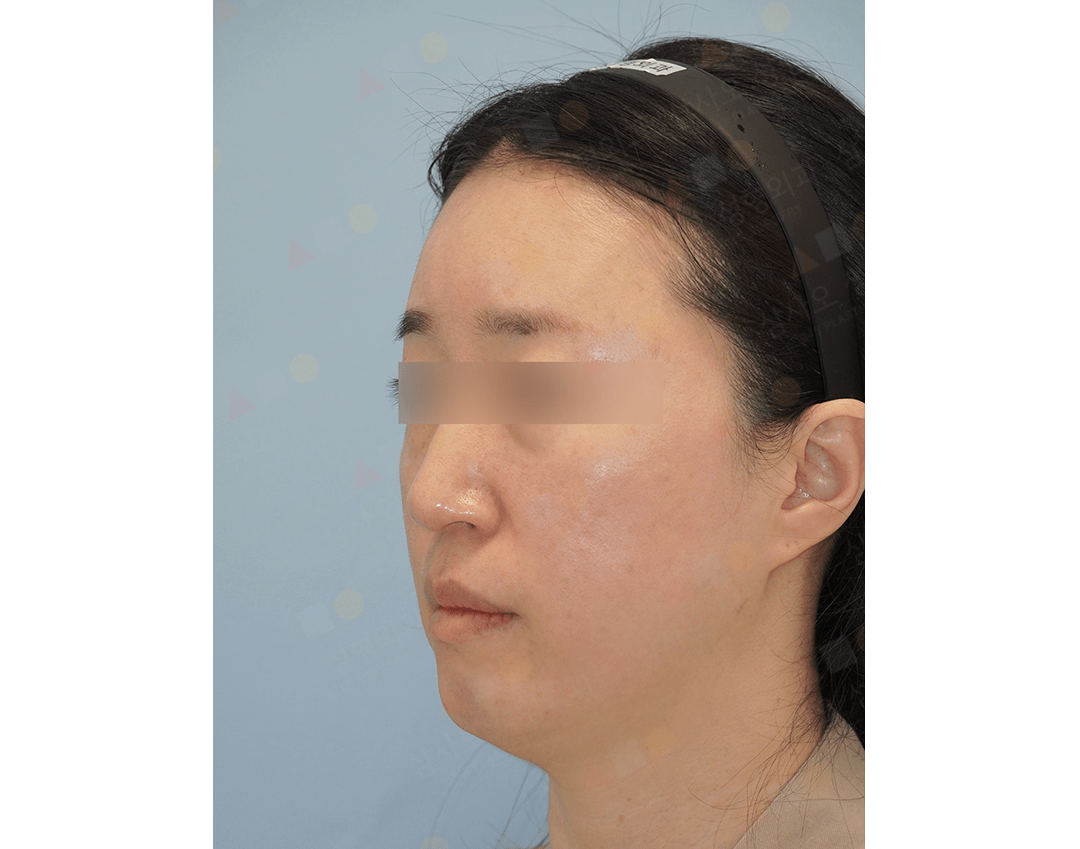 Woman in profile with headband on blue background.