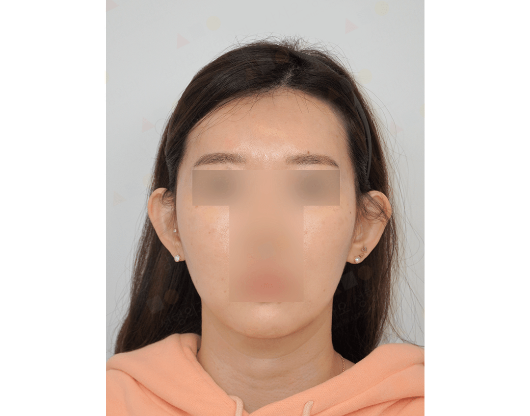 Person wearing peach hoodie, face blurred