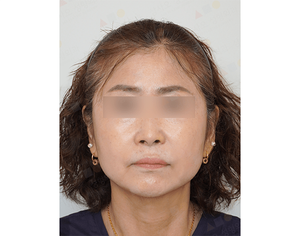 Close-up of a woman with blurred eyes