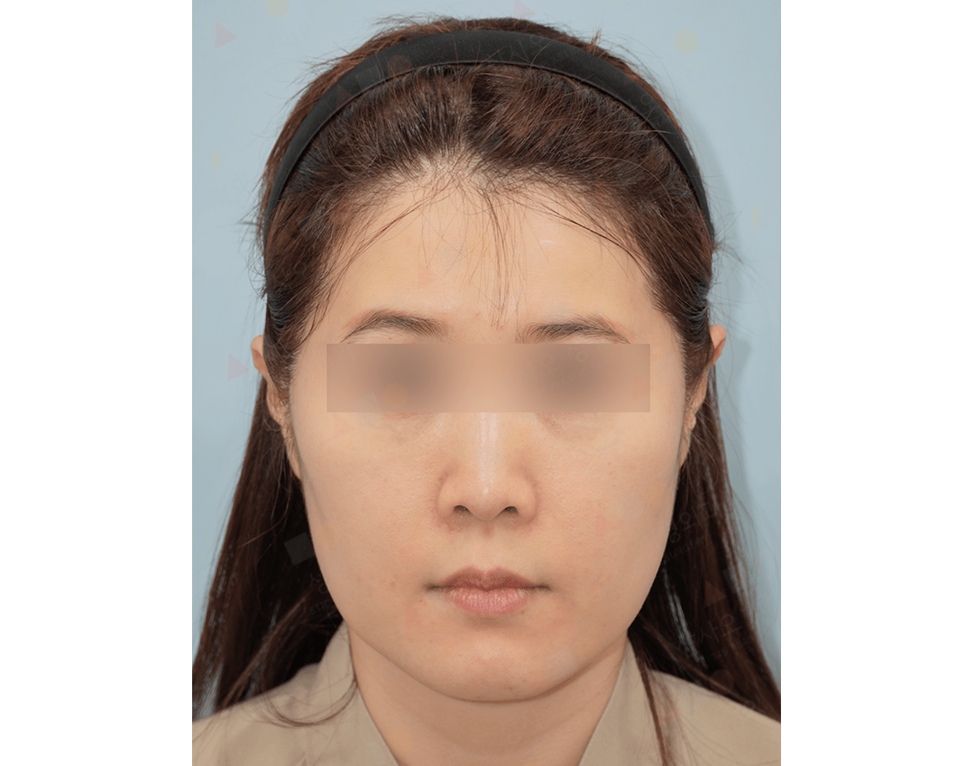 Person with neutral expression wearing a headband