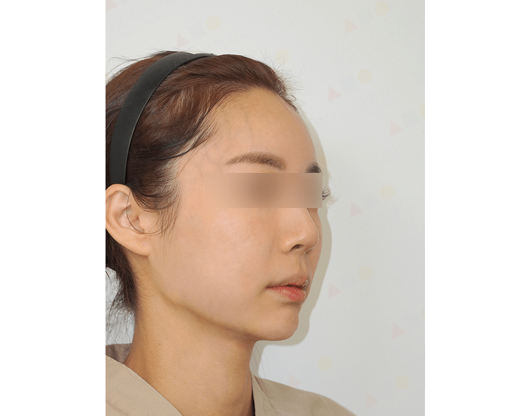 Woman with headband looking sideways.