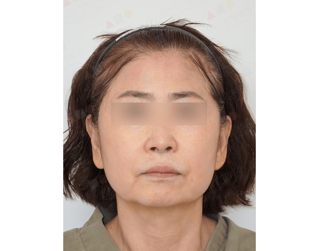 Front view of an adult woman's face.