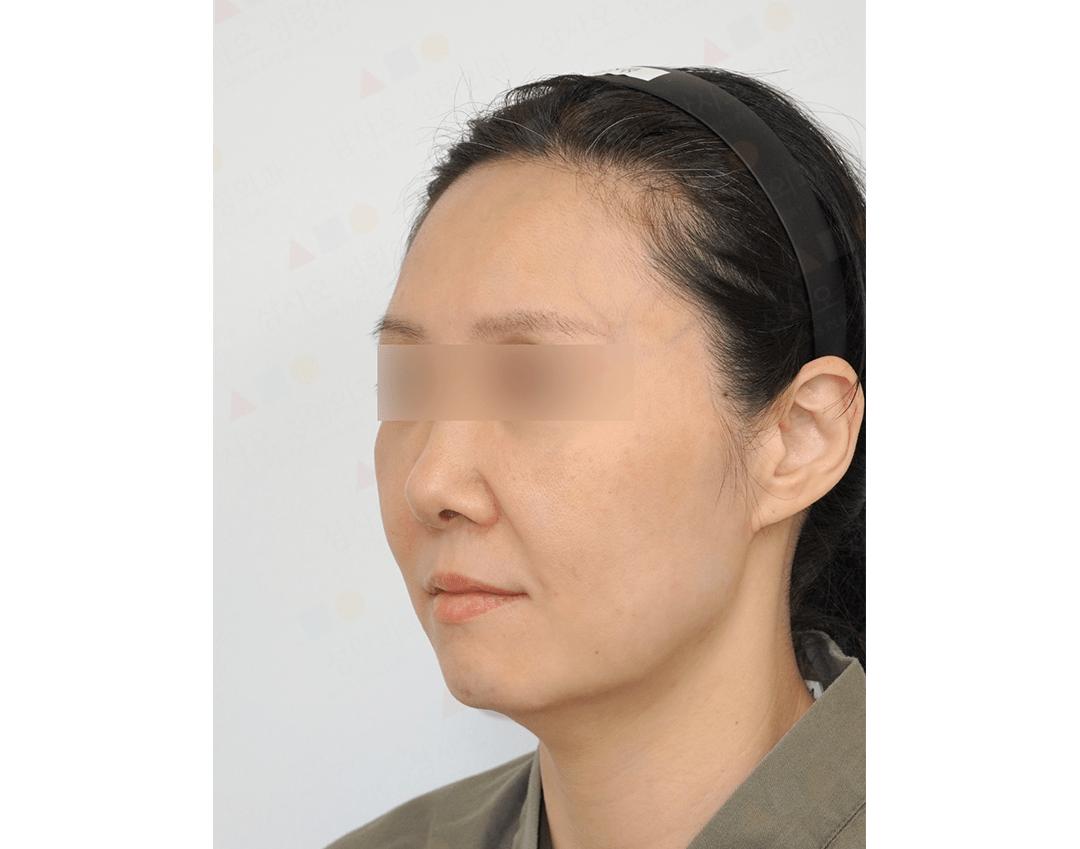 Side view of woman with blurred eyes