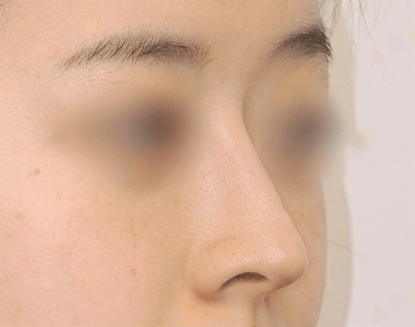 Close-up of person's nose and cheek