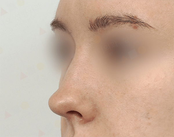 Close-up of person's face.